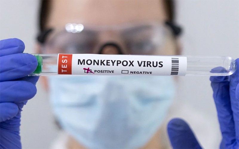 Ống đựng mẫu bệnh phẩm được đánh dấu dương tính với virus gây bệnh đậu mùa khỉ. (Ảnh: Reuters)